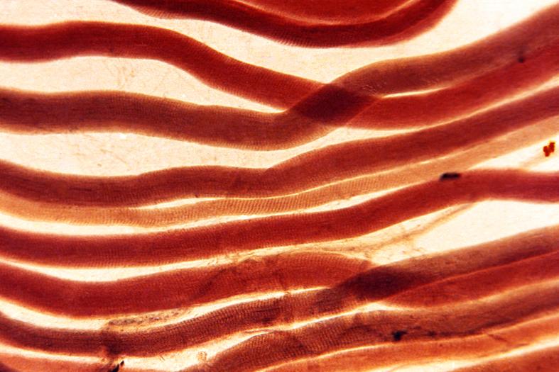 Crean músculo artificial que se cura solo y funciona como uno real