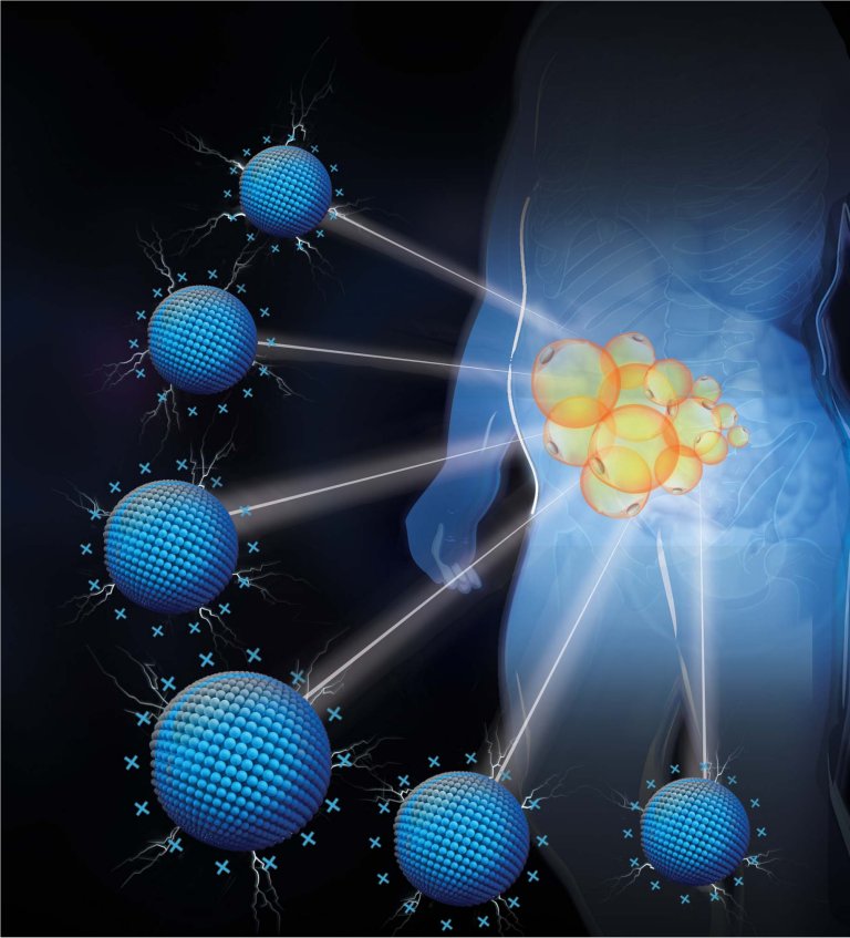 Científicos descubrieron una forma de perder grasa sin cirugía y justo donde queremos
Un equipo de la Universidad de Columbia ha desarrollado un nanomaterial capaz de reducir grasa justo donde se desea, sin necesidad de bisturí. El compuesto, llamado P-G3, podría transformar el tratamiento de la obesidad y la reducción estética de grasa de manera precisa y no invasiva.
Cómo funciona el P-G3 y por qué es diferente a la liposucción
La liposucción elimina físicamente el tejido adiposo mediante cirugía, pero el P-G3 actúa de forma completamente distinta. Se trata de un nanomaterial cargado positivamente que, al inyectarse en zonas específicas, interactúa directamente con el tejido graso.
En lugar de destruir las células, remodela su funcionamiento interno. El P-G3 impide que las células grasas más grandes acumulen un exceso de lípidos, al tiempo que promueve el desarrollo de células grasas más jóvenes y saludables. Este equilibrio no solo reduce el volumen visible de grasa, sino que mejora la forma en que el cuerpo maneja sus reservas energéticas.
En pruebas con ratones, las inyecciones de P-G3 no solo lograron una reducción notable de peso, sino que también mejoraron el metabolismo de la grasa. Es decir, el cuerpo comenzó a procesar y utilizar los lípidos de forma más eficiente.
Este enfoque, al actuar “desde dentro”, ofrece ventajas potenciales sobre procedimientos invasivos, reduciendo riesgos quirúrgicos y tiempo de recuperación, y sin cicatrices. Si los ensayos clínicos confirman su eficacia en humanos, podría cambiar la forma en que entendemos y tratamos el exceso de grasa localizada.
Resultados iniciales y aplicaciones médicas
Los resultados más prometedores provienen de pruebas iniciales en biopsias de grasa humana, que replicaron los efectos positivos observados en ratones. La capacidad del P-G3 para actuar de manera localizada abre un abanico de posibilidades tanto en la medicina como en la estética.
En el plano de la salud, su mayor potencial podría estar en el tratamiento de la grasa visceral. Este tipo de grasa, que se acumula alrededor de los órganos internos, está estrechamente vinculada a enfermedades graves como la diabetes tipo 2 y las afecciones cardiovasculares. Reducirla de manera dirigida podría significar un gran avance en la prevención y manejo de estas patologías.
En el campo estético, el P-G3 podría convertirse en una alternativa no invasiva para moldear el cuerpo. Tal como las inyecciones de toxina botulínica (Botox) han revolucionado la estética facial, estas inyecciones podrían permitir una reducción selectiva de grasa en zonas problemáticas como abdomen, muslos o brazos, sin pasar por el quirófano.
Además, la tecnología de direccionamiento a tejido graso podría servir como plataforma para administrar otros tratamientos, como medicamentos o terapias genéticas, directamente en la grasa. Esto permitiría minimizar efectos secundarios sistémicos, aumentando la eficacia del tratamiento.
El futuro de la reducción de grasa personalizada
El equipo de la Universidad de Columbia ya ha solicitado patentes para proteger la innovación y está trabajando en perfeccionar el P-G3 para optimizar su seguridad y precisión. Entre los objetivos se incluyen reducir aún más cualquier riesgo de efectos adversos y mejorar la capacidad del nanomaterial para dirigirse únicamente a las zonas deseadas.
Si este desarrollo supera con éxito las fases clínicas, podríamos estar ante una herramienta capaz de ofrecer tratamientos personalizados para la obesidad, una condición que afecta a más de mil millones de personas en el mundo.
La combinación de un enfoque médico y estético hace que el P-G3 tenga un potencial de mercado enorme, pero también un profundo impacto en la salud pública. Poder reducir grasa visceral de manera segura y focalizada significaría disminuir la incidencia de enfermedades metabólicas que hoy representan un desafío global.
Aunque todavía queda camino por recorrer antes de que llegue a clínicas y hospitales, los avances actuales marcan un cambio de paradigma: pasar de métodos invasivos y generalizados a soluciones precisas, adaptadas a las necesidades de cada persona y con beneficios que van más allá de la estética.
El P-G3 podría convertirse en la próxima gran revolución en el tratamiento de la grasa corporal. Su capacidad para actuar de forma localizada y no invasiva abre la puerta a una medicina más precisa y segura, con el potencial de cambiar tanto la salud metabólica como la estética corporal.
Referencia:
Biomaterials/Polycationic PAMAM ameliorates obesity-associated chronic inflammation and focal adiposity. Link