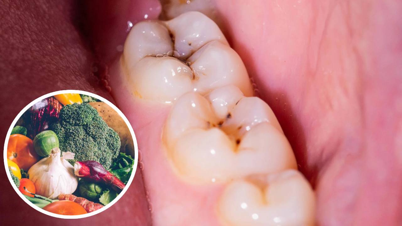 Se ha encontrado una molécula natural que elimina el 90% de la placa que causa las caries