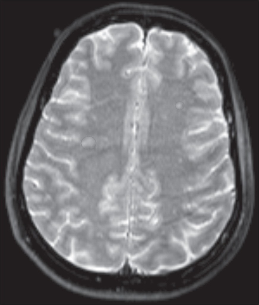 Una rara afección cerebral hizo que esta mujer viera dragones por todas partes 2 Una rara afección cerebral hizo que esta mujer viera dragones por todas partes