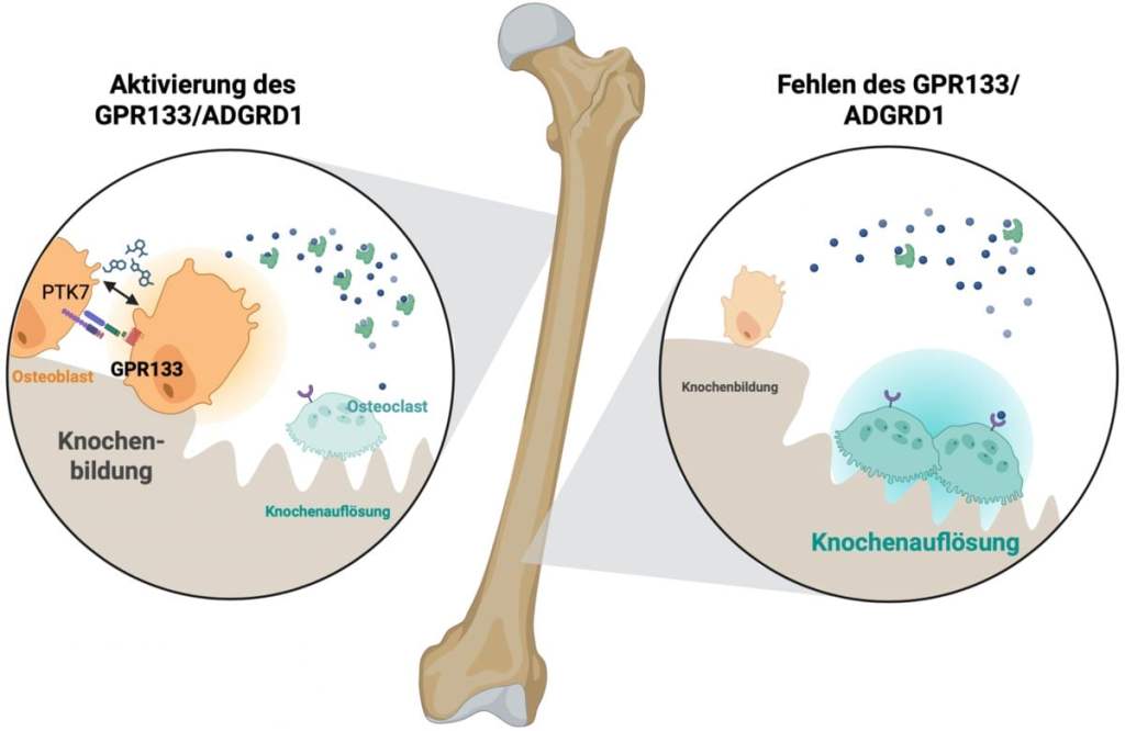 Osteoporosis: el interruptor óseo que promete frenar la enfermedad 2 Osteoporosis - Osteoporosis