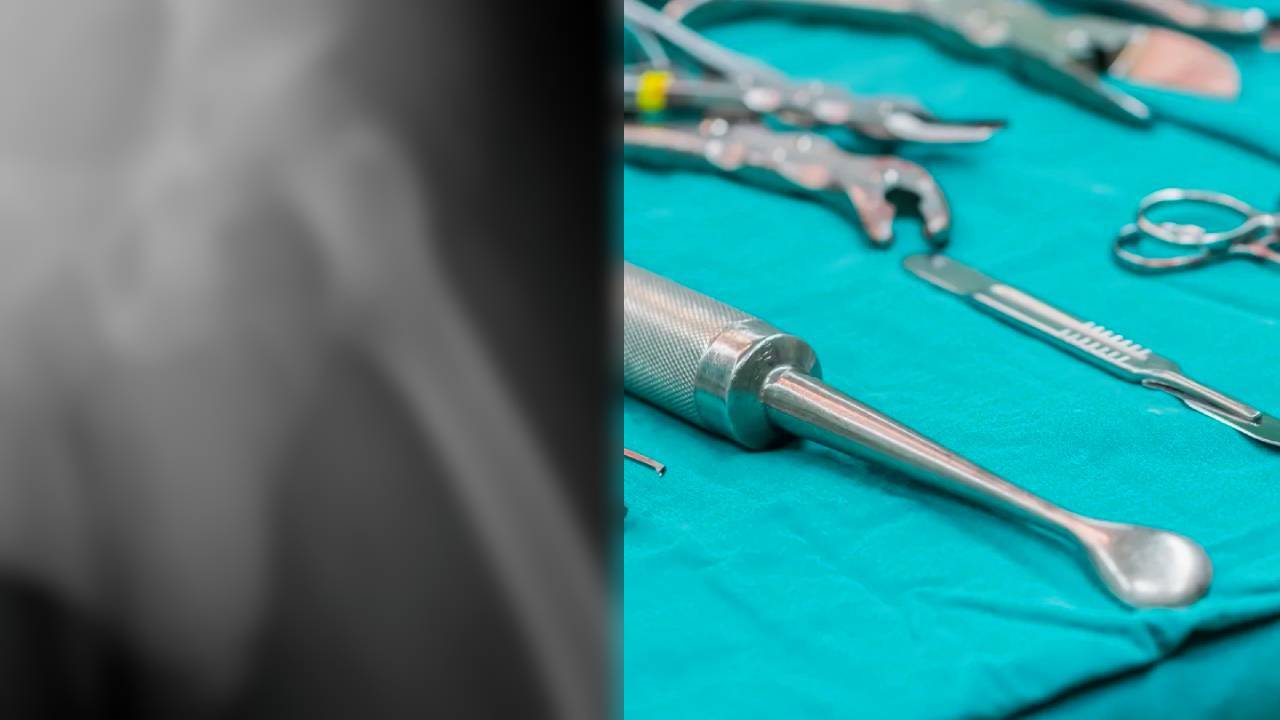 Autopsy Revealed That a 78-Year-Old Man Had 3 Penises: An Extremely Rare Medical Phenomenon