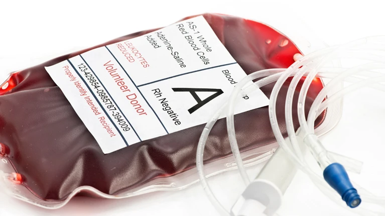 Primer trasplante humano de riñón modificado con sangre “universal”