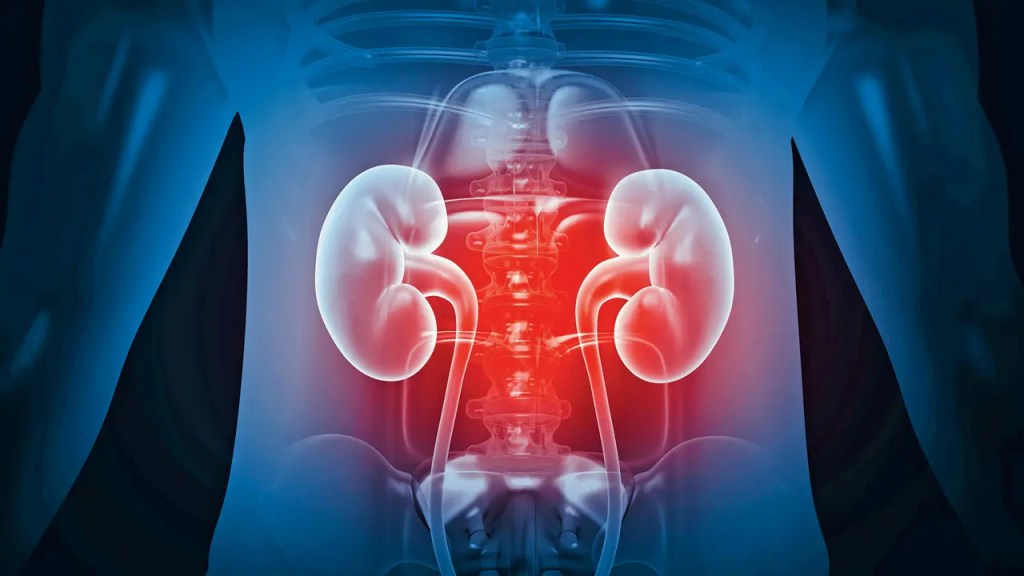 trasplante - trasplante