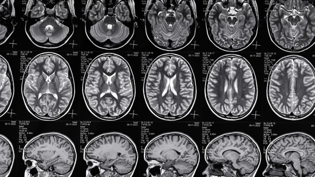 Cómo el estrés y la gratitud moldean tu cerebro: del cortisol a la conexión neural