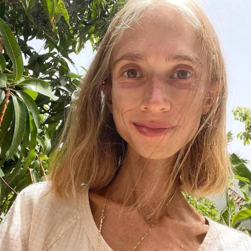 La trágica historia de Karolina Krzyżak, la influencer frutariana hallada sin vida en Bali