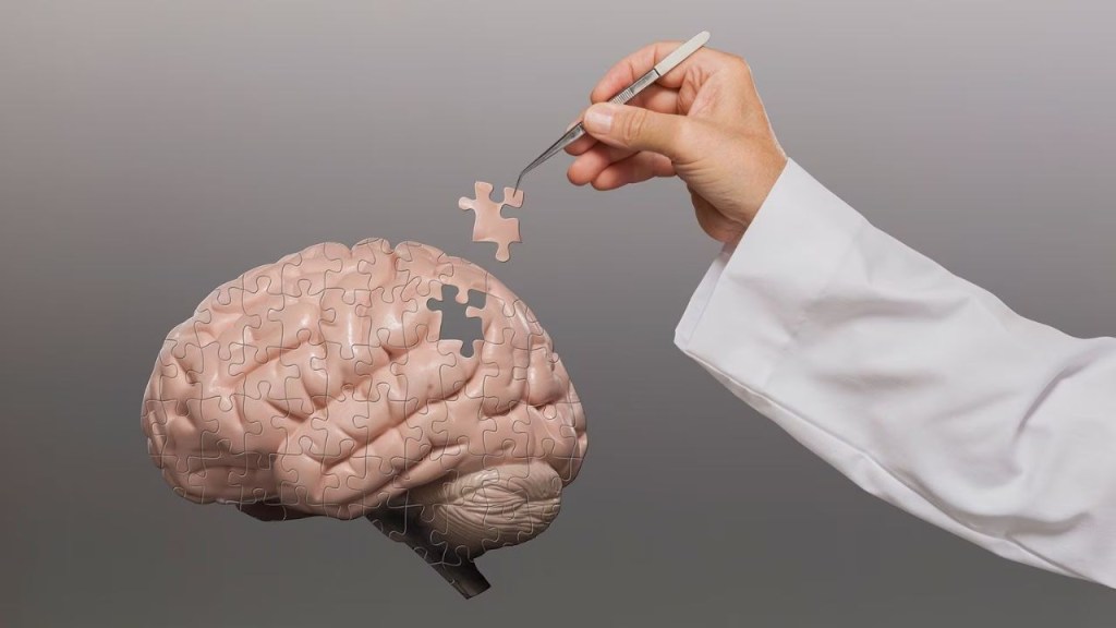 parkinson - parkinson