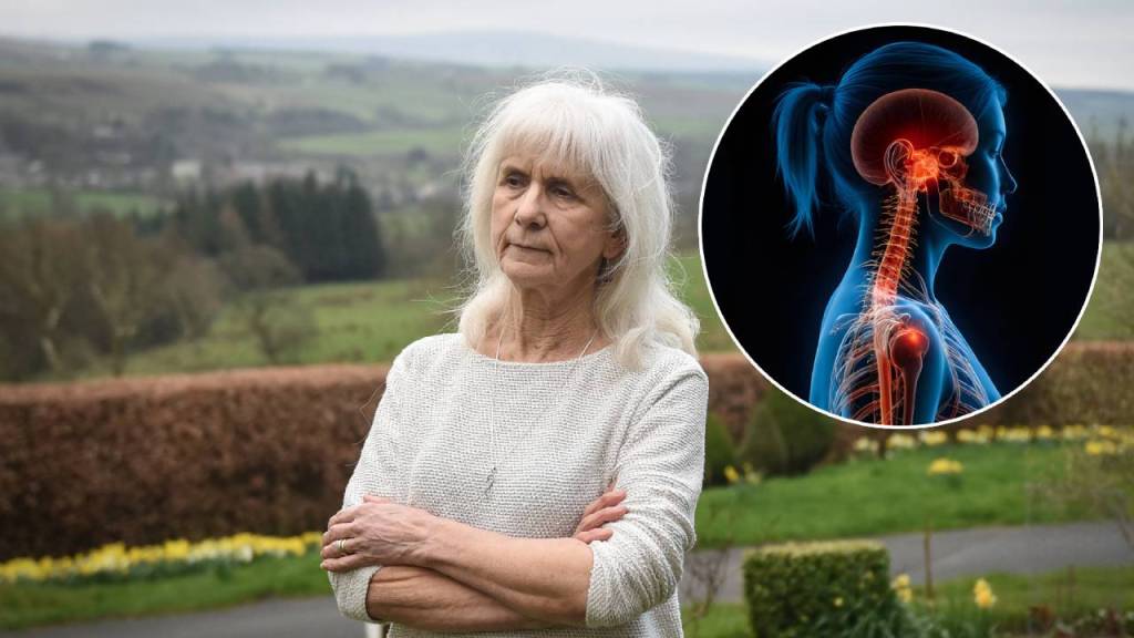 Jo Cameron: la mujer que no siente dolor y el hallazgo genético que podría revolucionar la medicina