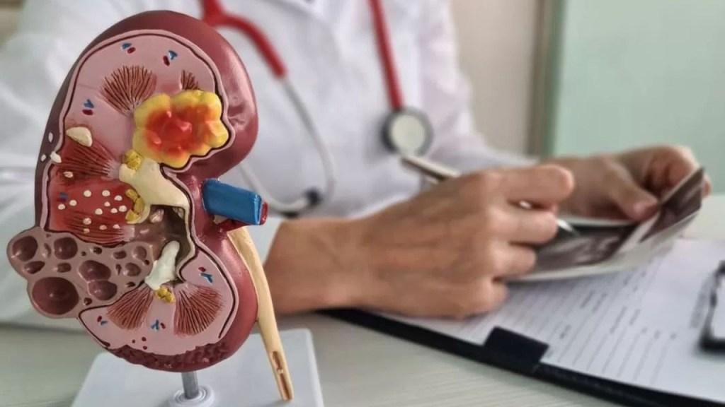 Riñones bioartificiales: un avance hacia el futuro de los trasplantes 1 riñones - riñones