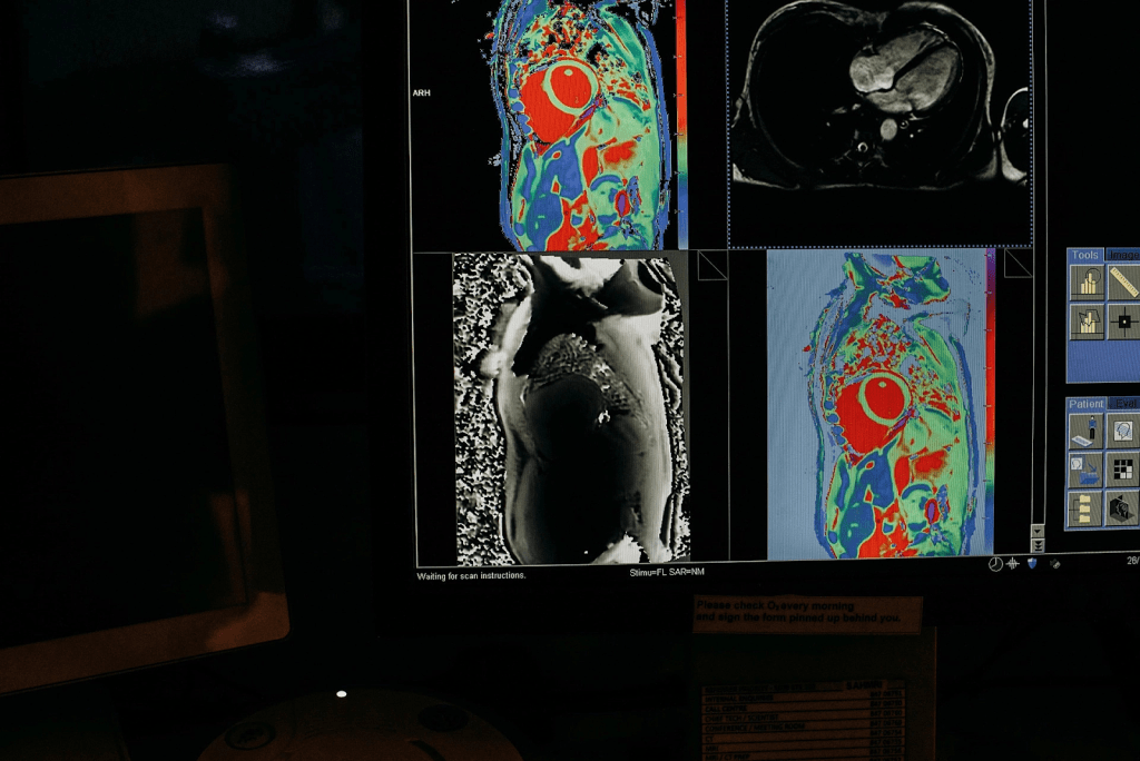 nanoparticulas - nanoparticulas
