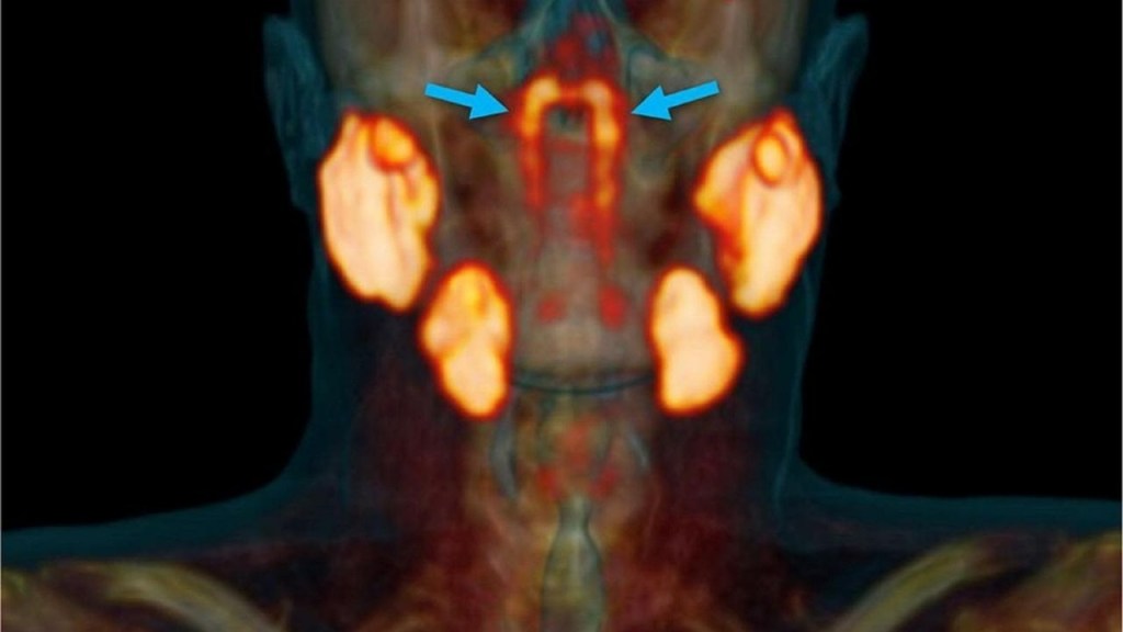 nuevo organo - nuevo organo