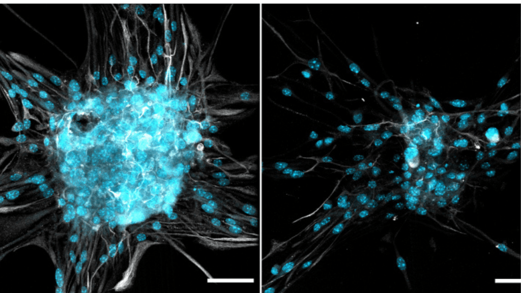 Un parásito cerebral más activo de lo que creíamos: lo que revela la ciencia