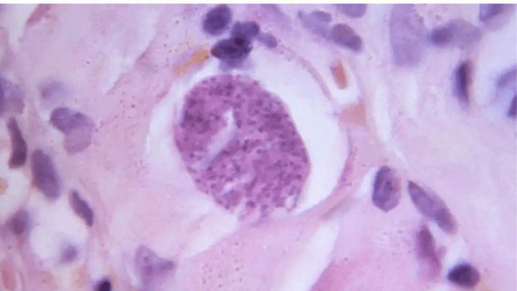 parasito,cerebral - parasito