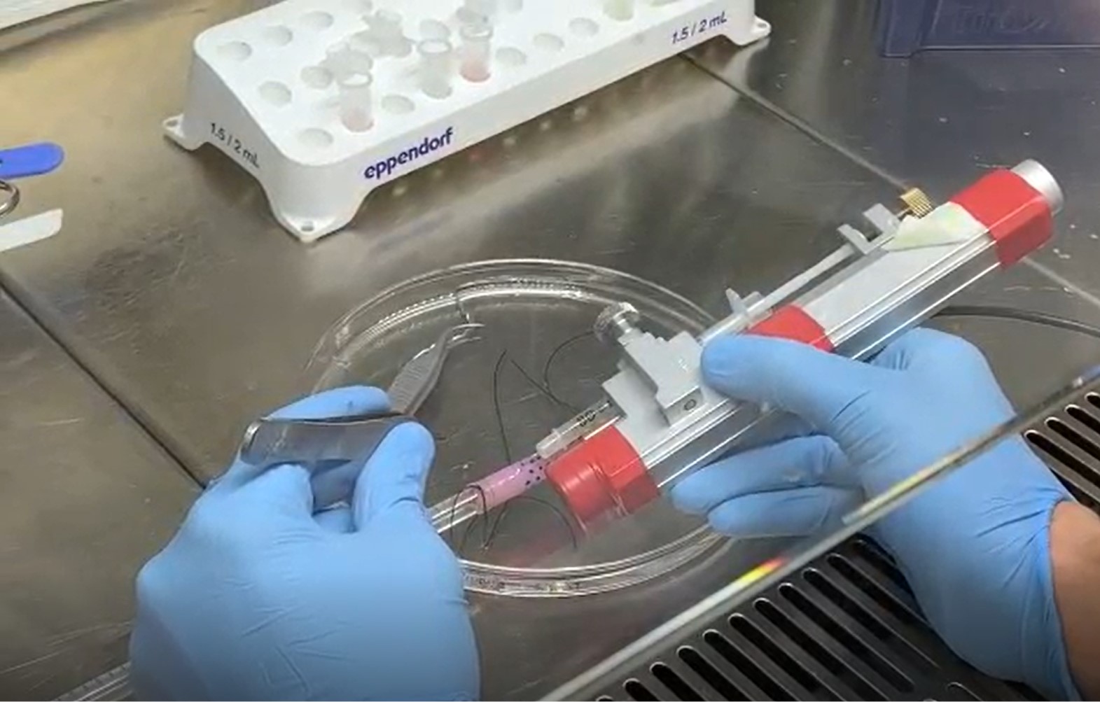 Crean el primer esófago artificial funcional: un avance que podría salvar a bebés con malformaciones graves