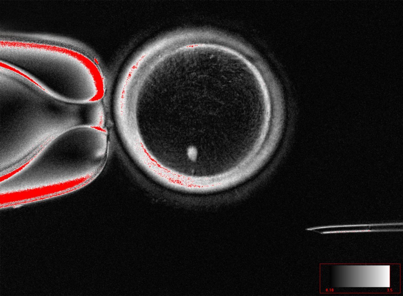 Científicos logran crear óvulos funcionales a partir de células de la piel humana