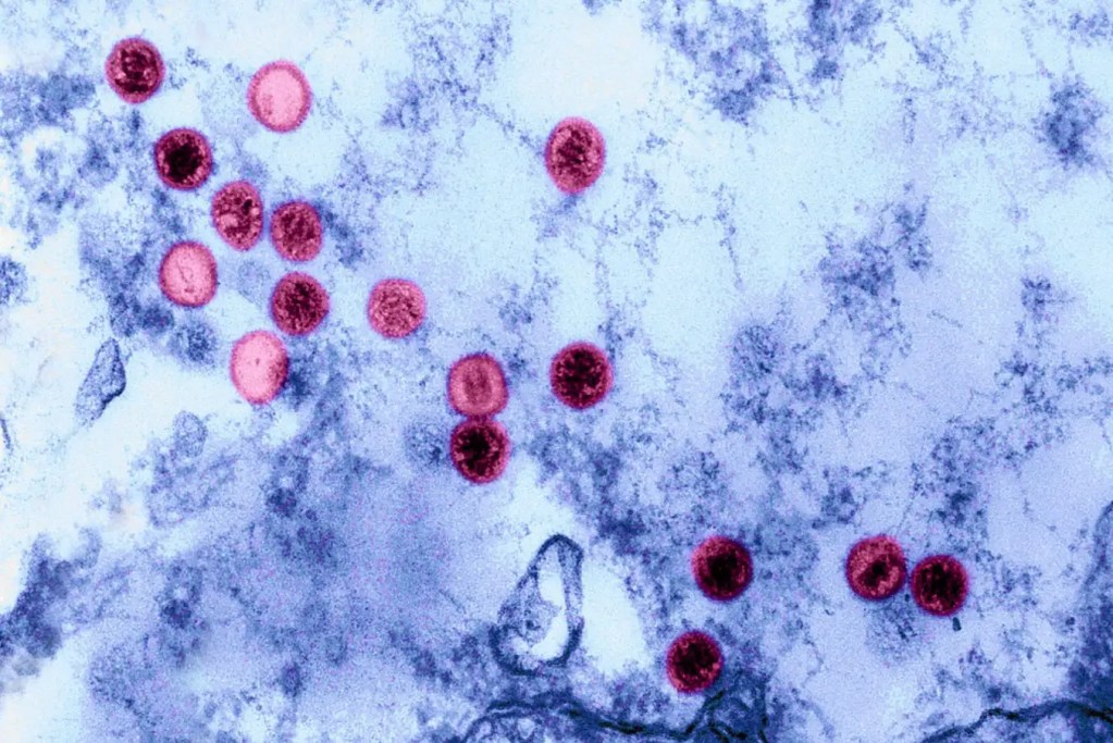 virus - virus